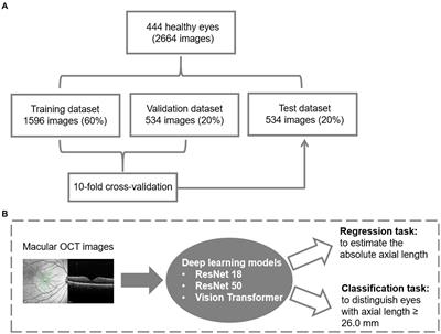 Deep learning-based estimation of axial length using macular optical coherence tomography images